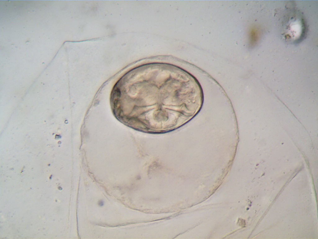 tape worm egg found in sample from nature