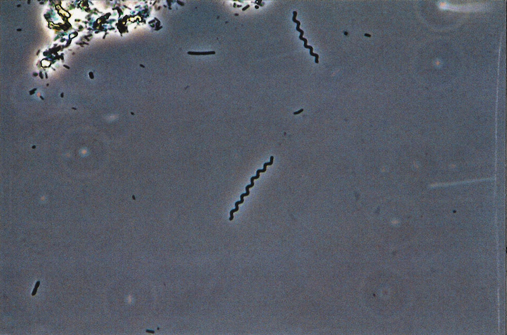 Soil spirochete, 40x/0.75 Ph Neofluar, 1.6x Optovar