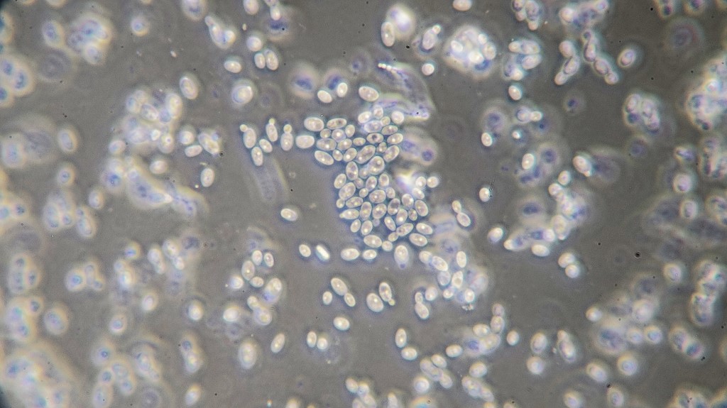 Packed yeast cells. 4-6 um. Bright M.