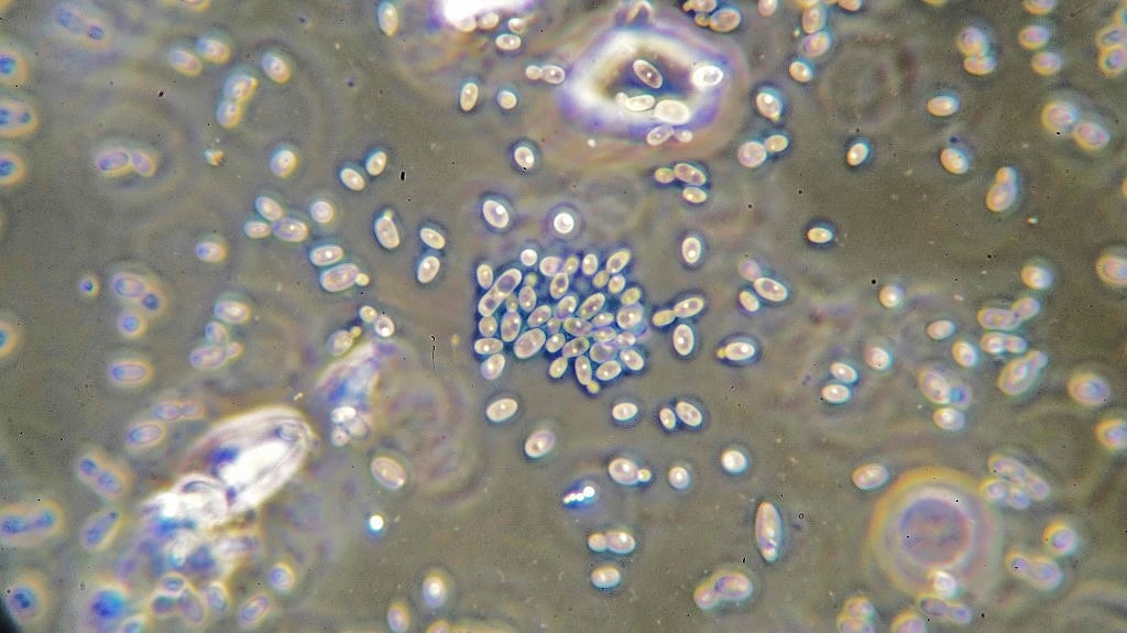 Packed yeast cells. One at least appears to be a different species, perhaps a developing cladosporium. Some of those in the sample were 60 or 80 microns long by picture time with only 3-5 cells .
