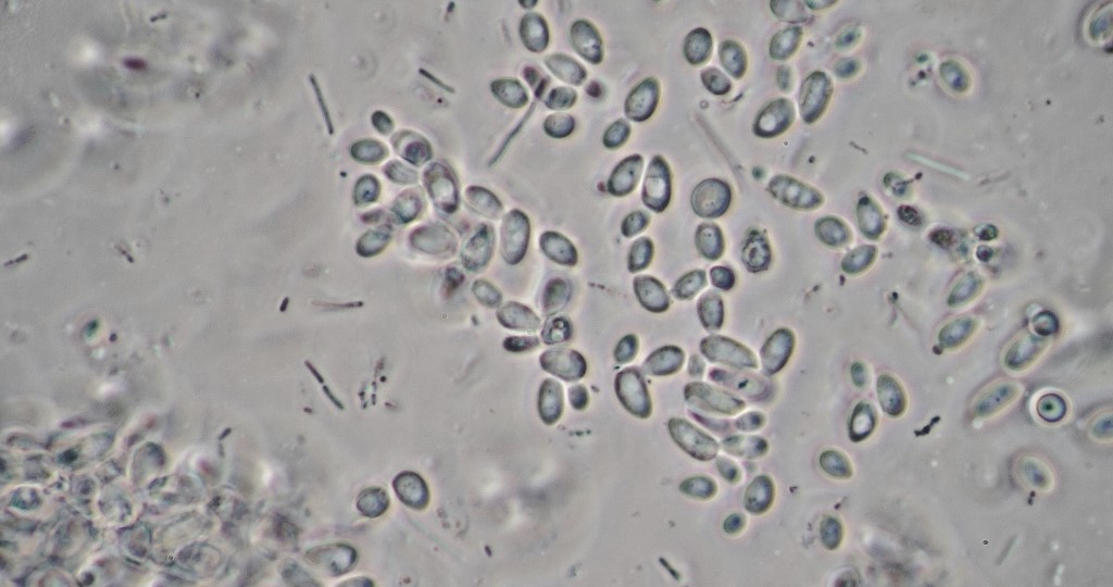 Several yeast species . 100X B-Minus M phase achromat.<br /> 180 um across field