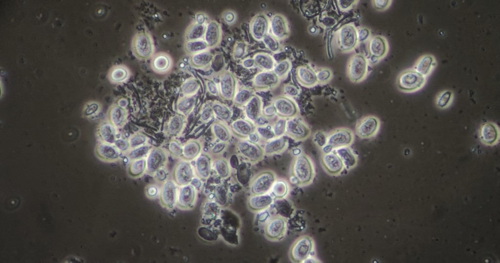 Nice clutch of some opportunistic yeasts.<br /> 100X dark phase planachro.<br /> 180um across field