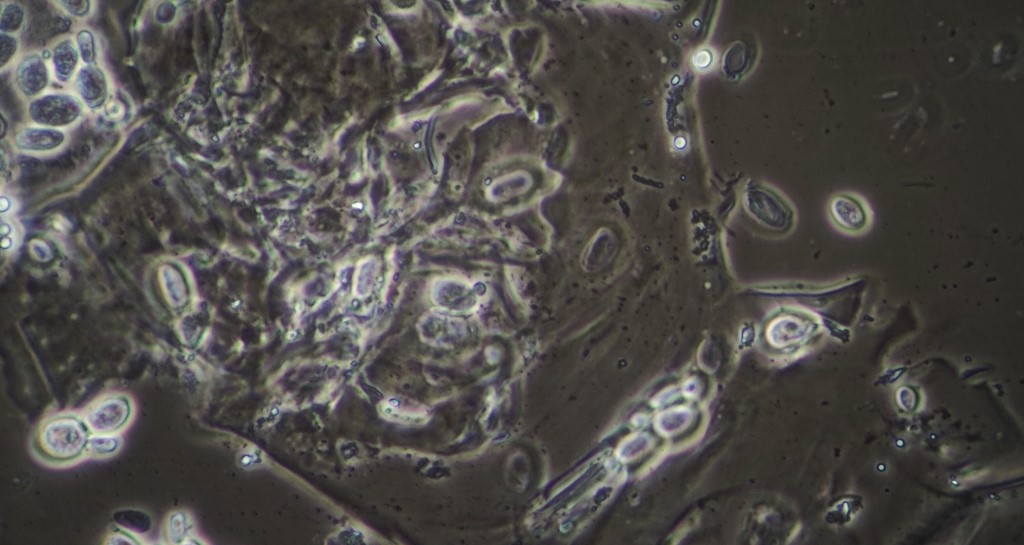 Cabbage cells, with yeasts and bacteria.<br /> 100X dark phase planachro. field is about 180 um across