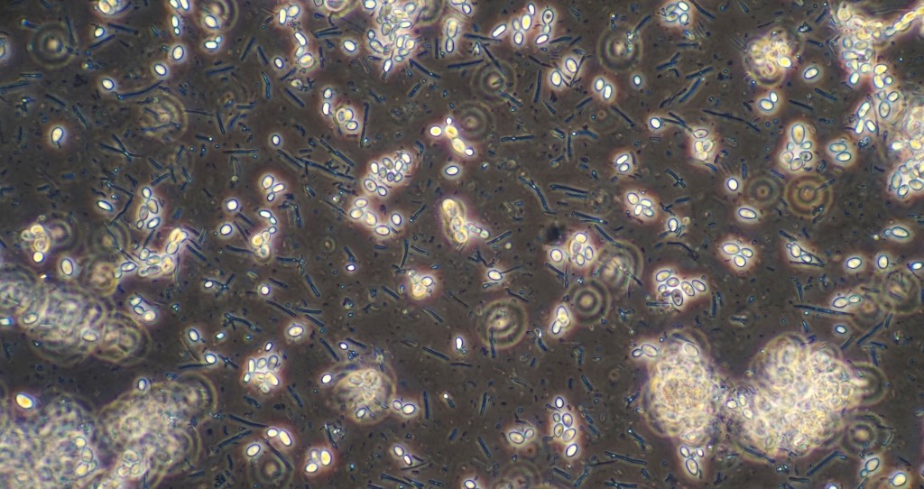 Just about as much yeast as bacteria and very little evidence of the bacterial species that should be there. 40X dark phase planachro. Field is about 450 um across