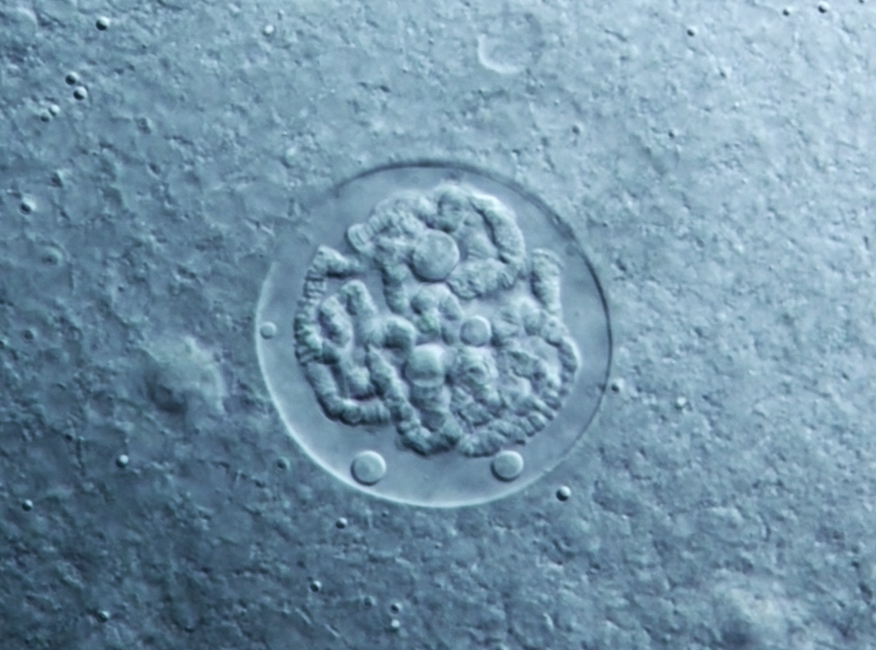 Drosophila polytene chromosomes, 40/0.95 DIC