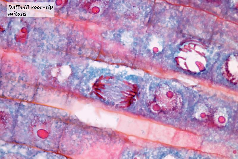 ws_daffodil root mitosis 2.jpg