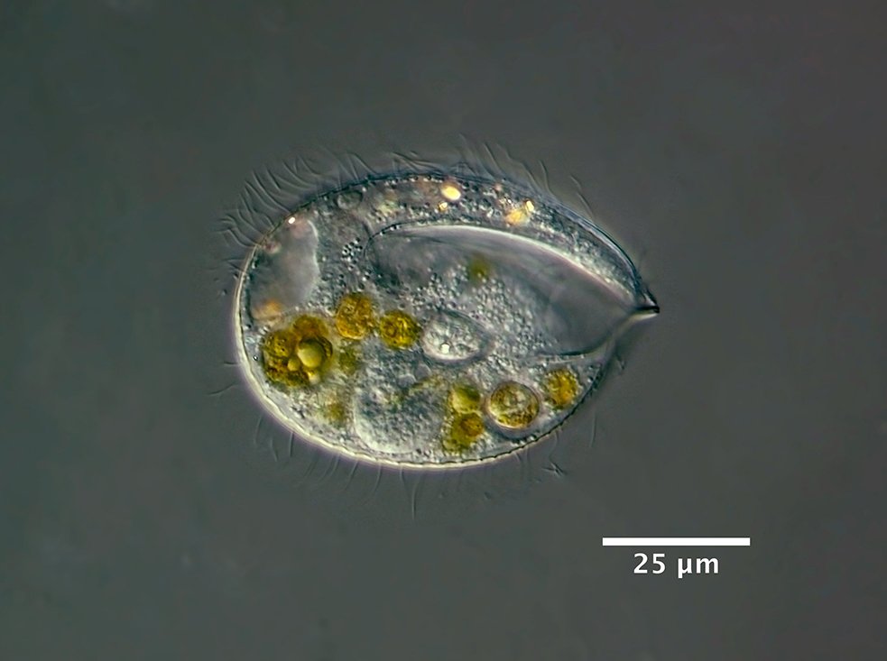 Unknown ciliate, 40/0,95 DIC