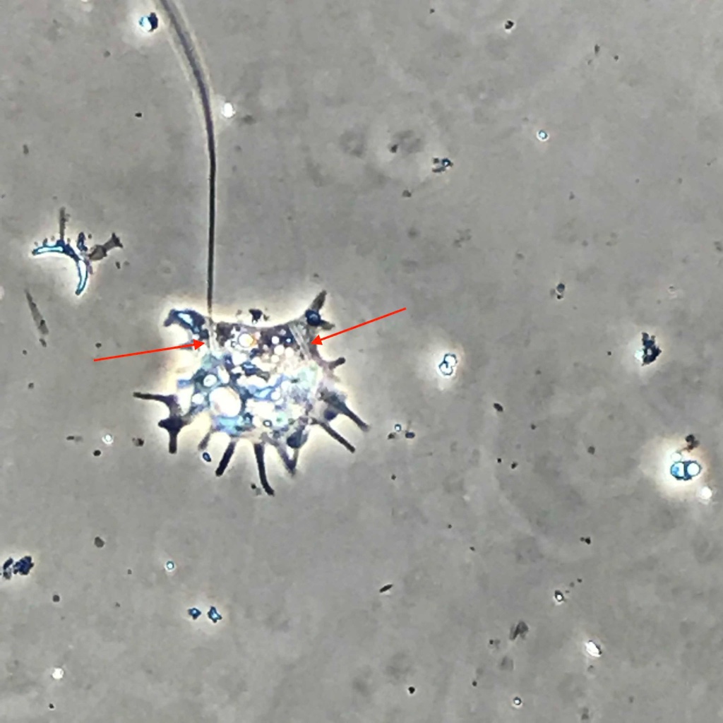 amoeba2_20x_ph2.jpg