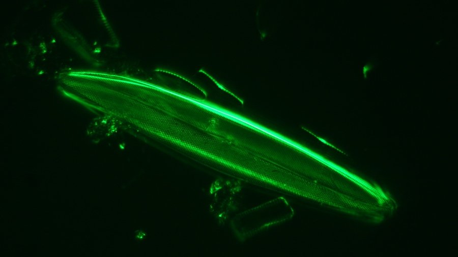 (4) 100X1.25 Achromat oil, Ultracondenser oil, 543nm filter, single image.JPG