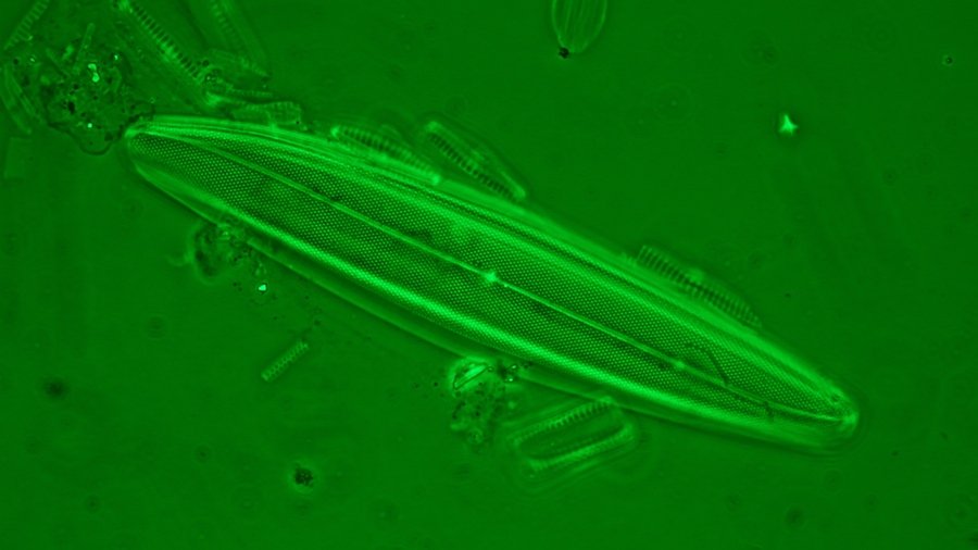 (7) 100X1.3 Pl.Apo oil phase c., 546nm filter, single image.JPG