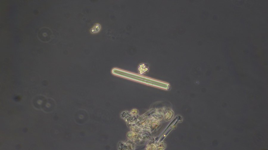 A diatom or an unknown.JPG