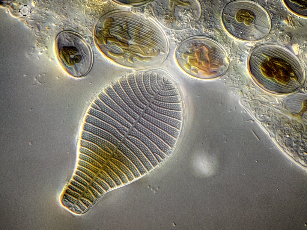 Podocystis adriatica (60µm) and Cocconeis sp-.jpg