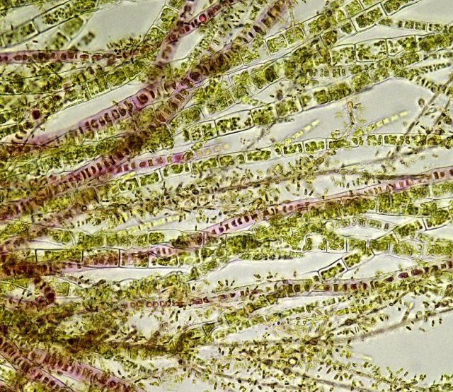 green leaf +green fibers+red fibers marine alga C, 2months old slide. Fructose syrup .jpg