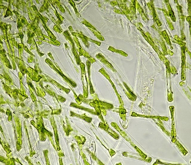 green marine alga B, 2months old slide. Fructose syrup.jpg