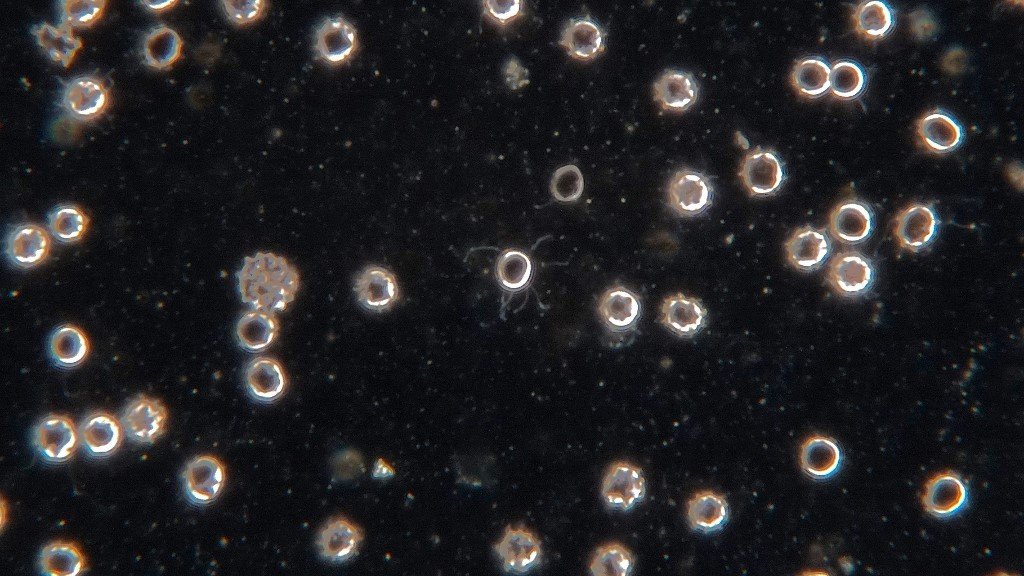 This image has been excessively digitally contrast enhanced in order to reveal details of what are very transparent organisms. They are presumably human blood parasites. The 8 or so x .3 micron bodies appear to have spores attached or possibly joints where longitudinal division is taking place.Dark field with a planapo 100X 1.32 objective. Cropped.