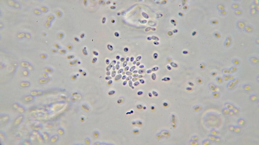 97X 1.25 B-Minus L phase achromat