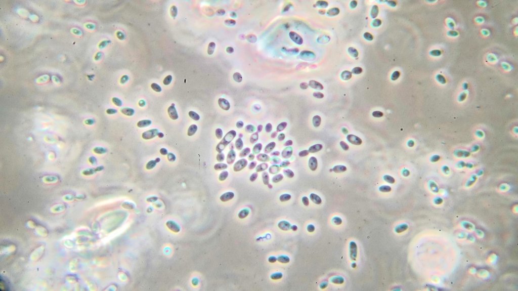 97X 1.25 Bright M phase achromat