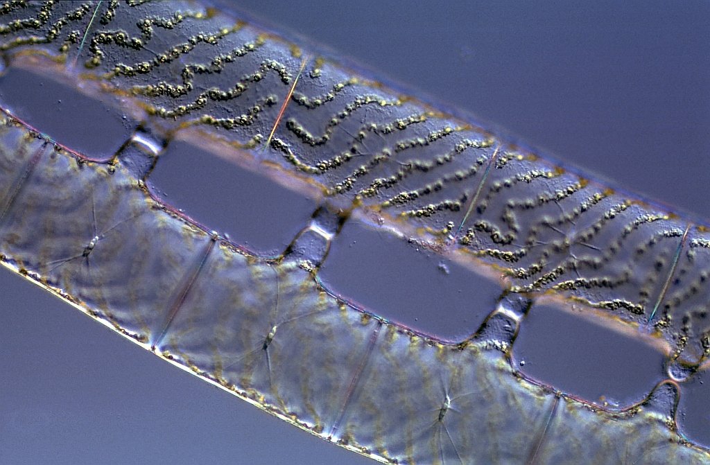 A I-1-24-Spirogyra-glabra-0 140-Gartenteich-- 1024.jpg