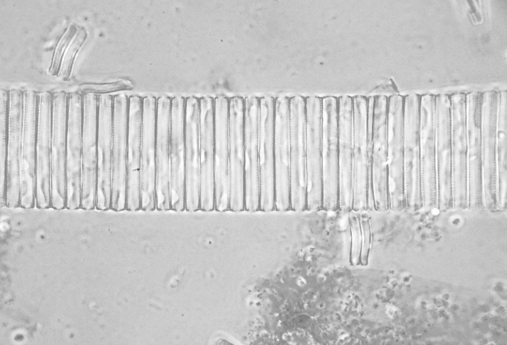 Bright phase achromat. 100X 1.25  oil immersion. resolution details as above.