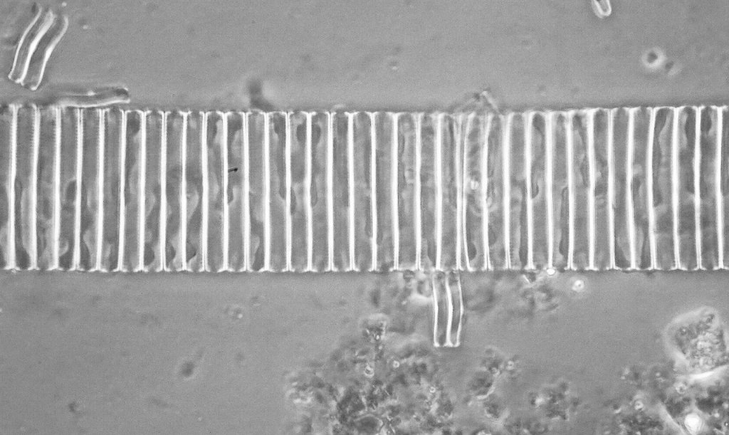 Dark phase planachro . 100X 1.25 oil immersion. The space between Each cell is about 5 microns.  Individual  details are down to .2 microns or so.