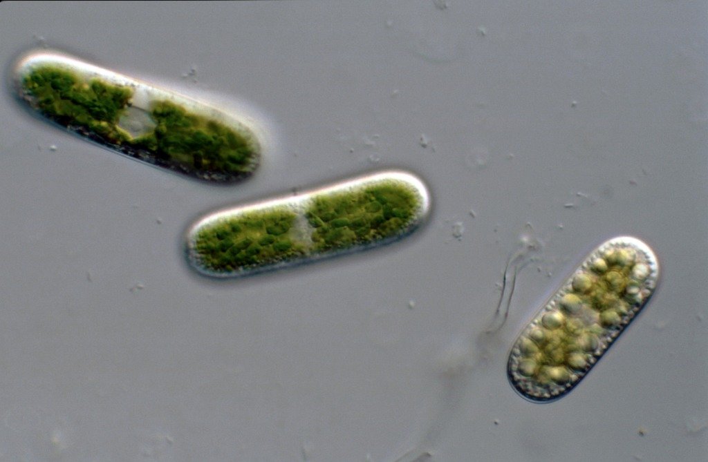 I-1-2-Cylindrocystis--L 70 B 20-Wockninsee--.jpg