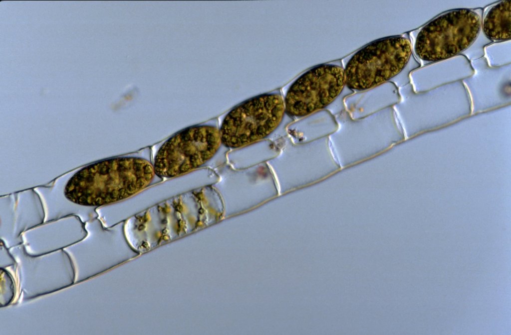 I-1-21-Spirogyra-porticalis-20+2,5-Hetlingen--.jpg