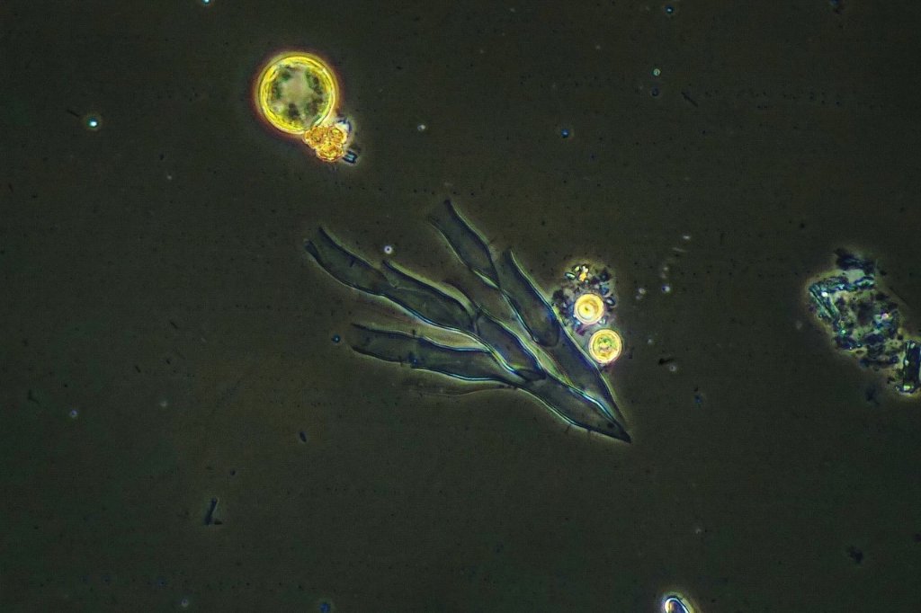 A more colonial example. All encountered were motionless and in appearance, inoffensive. I could detect no cilia or locomotive method of any kind. 40X Dark Phase, cropped