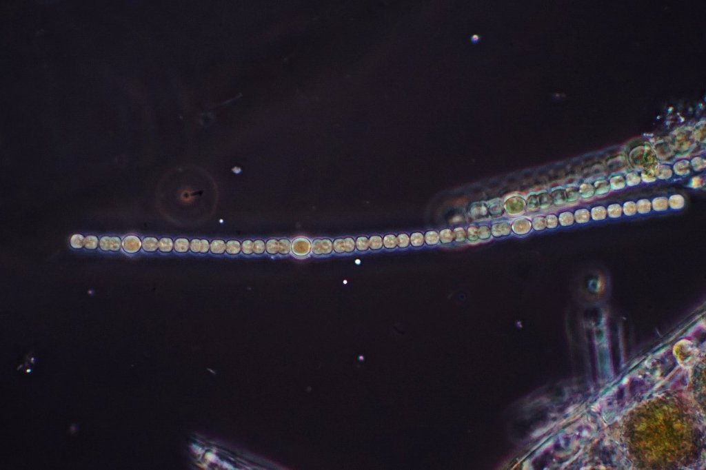 100X Dark Phase, cropped. Anabaena, likely.