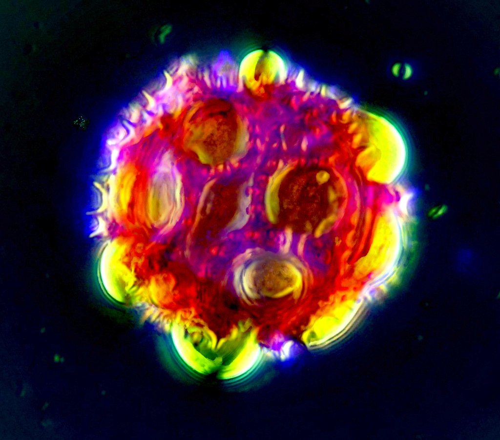 Pollen Löwenzahn 40er Öl DIC gestackt V2 Hochpass Werte 1024.jpg