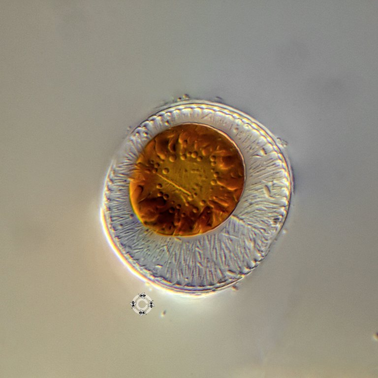 Campylodiscus sp. 45µm.jpg