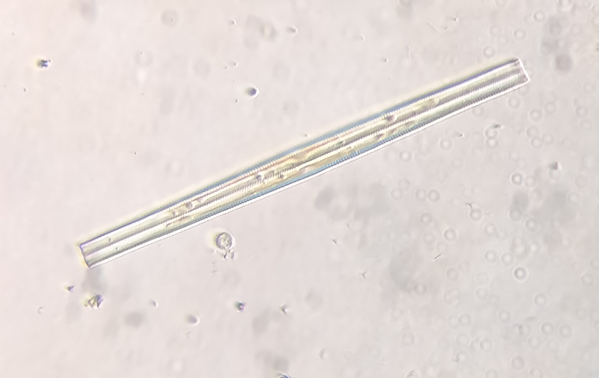 diatom_example.png