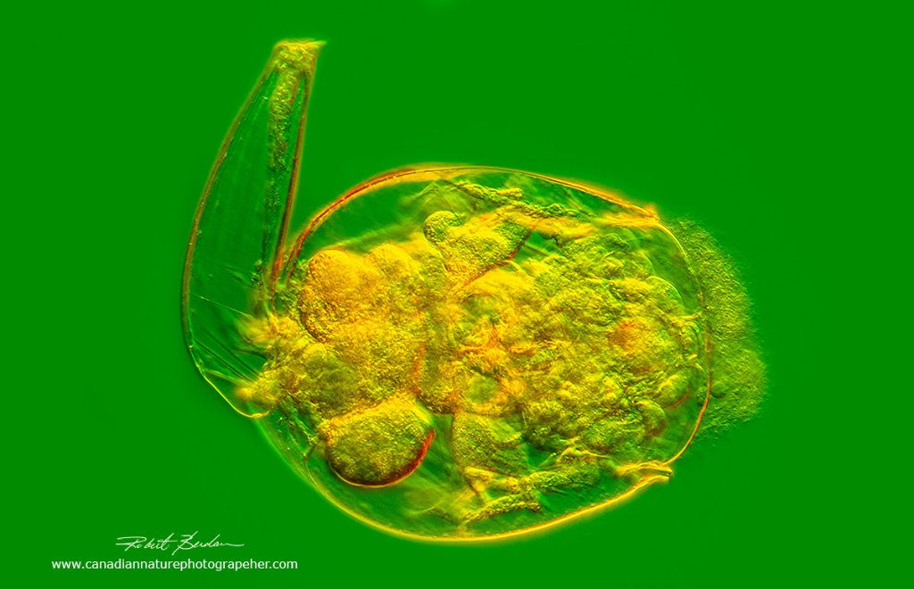 Rotifer (Brachionus) with Rheinberg