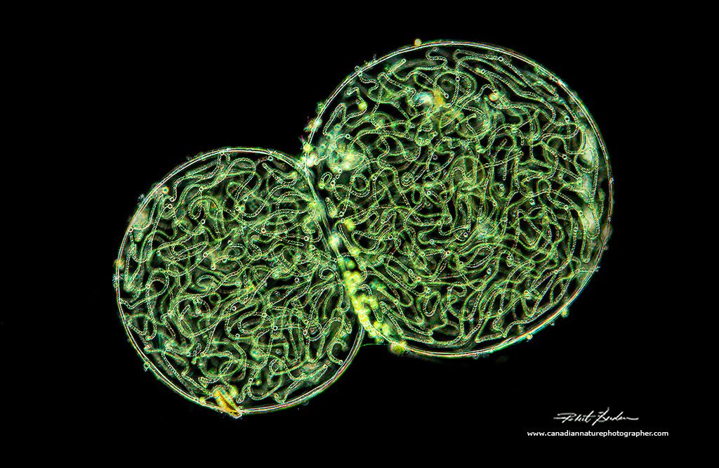 Nostoc  caeruleum  Darkfield microscopy 5X objective