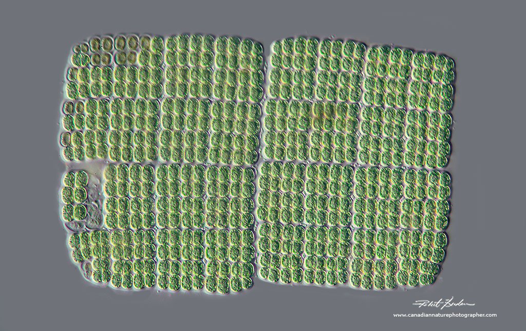 Merismopedia - form regular rows and were the first solar cells - focus stack 400X