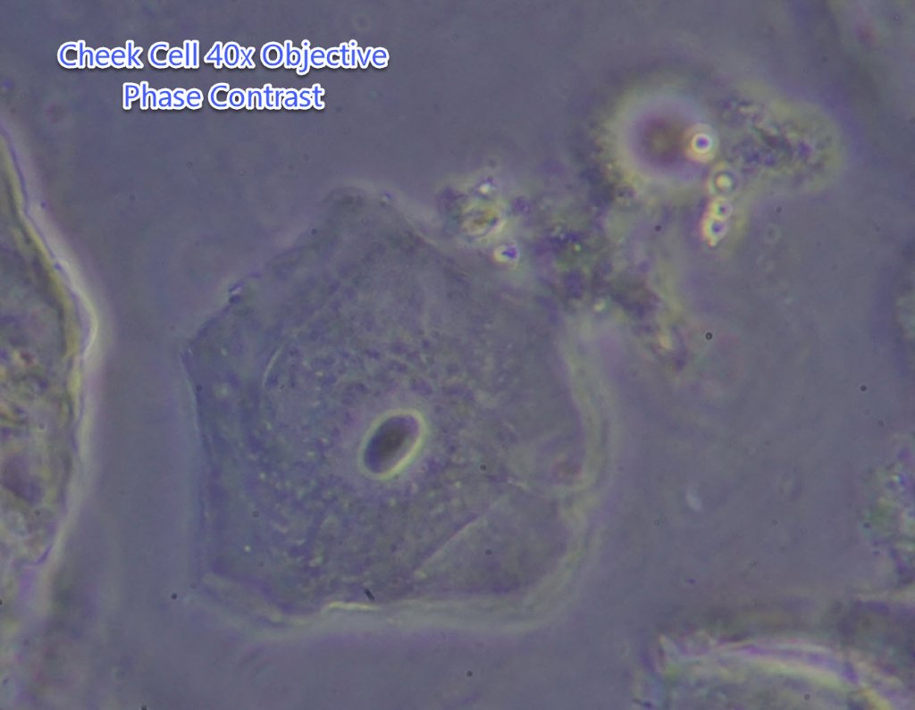 Cheek Cell T720Q 40x Phase Contrast