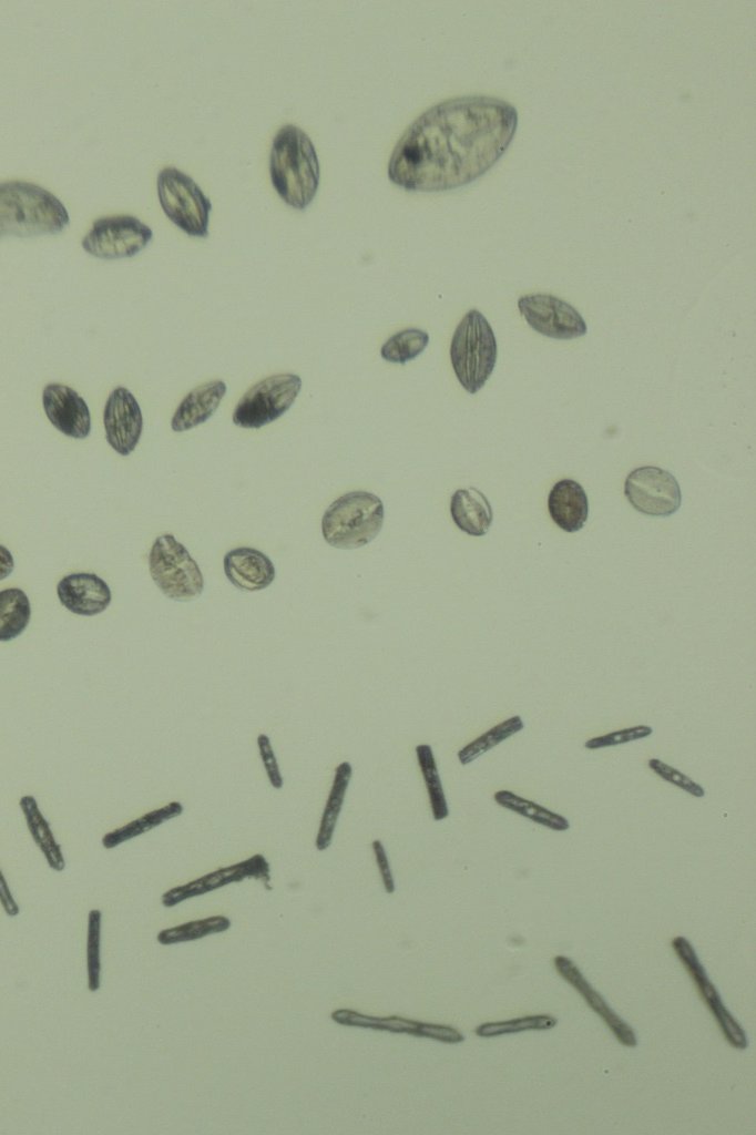 Monterey Diatoms7.jpg