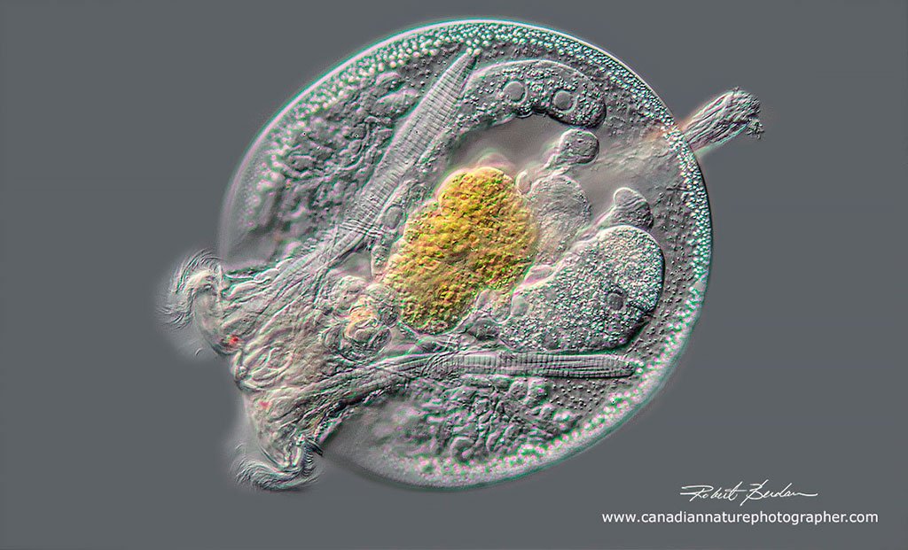 estudinella patina  - Turtle rotifer DIC