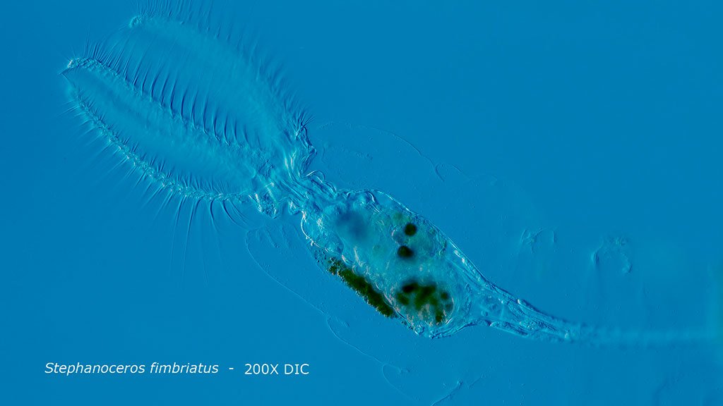 Stephanoceros fimbriatus is a sessile rotifer DIC