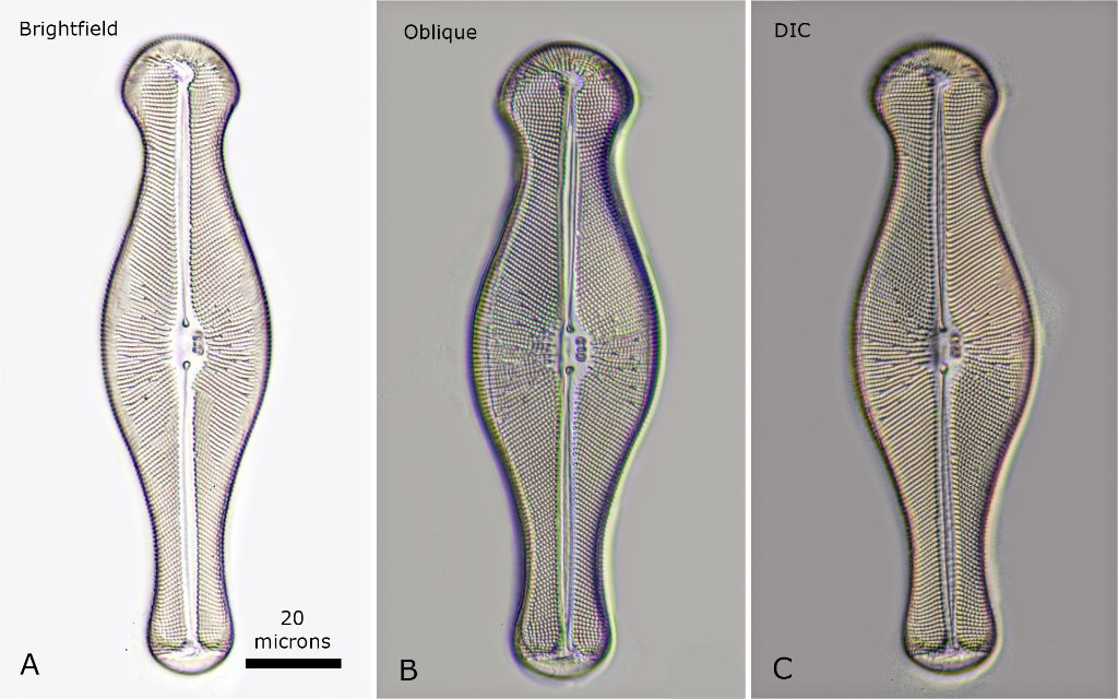 Comparision between Brightfield, Oblique and DiC microscopy