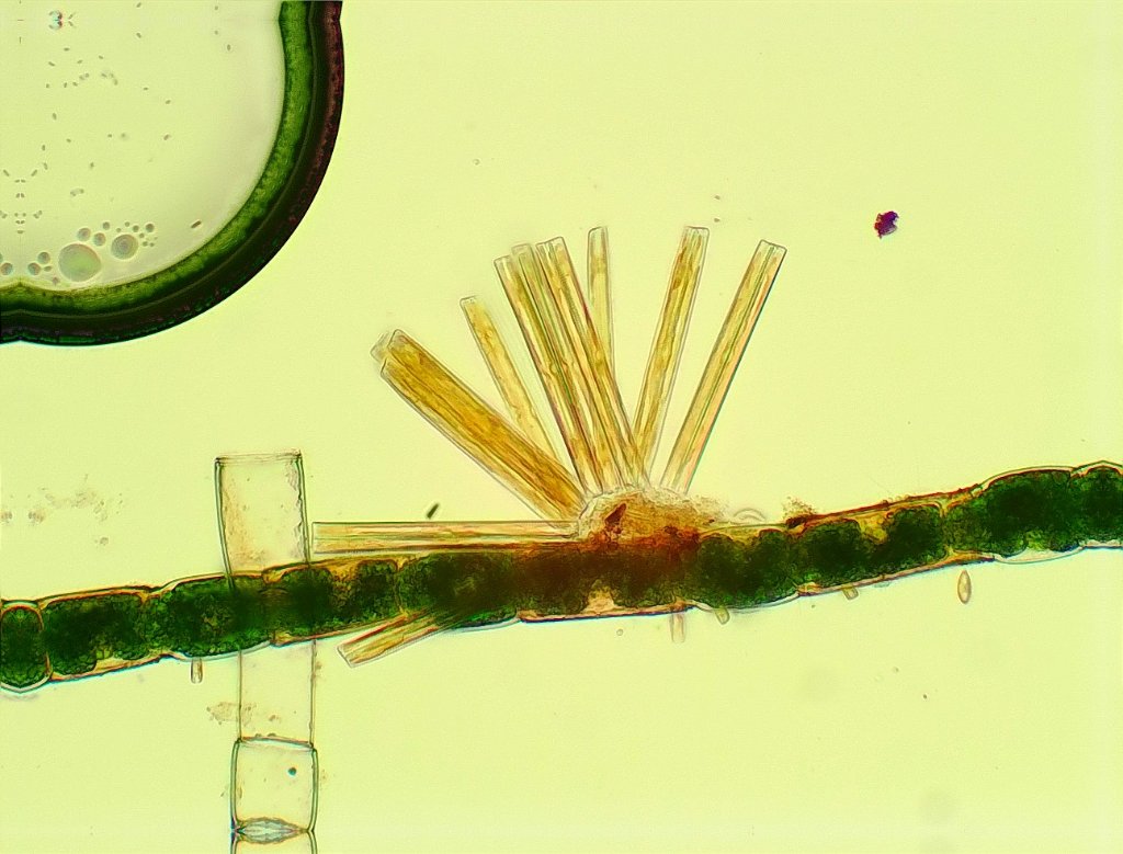 Diatom colony.jpg