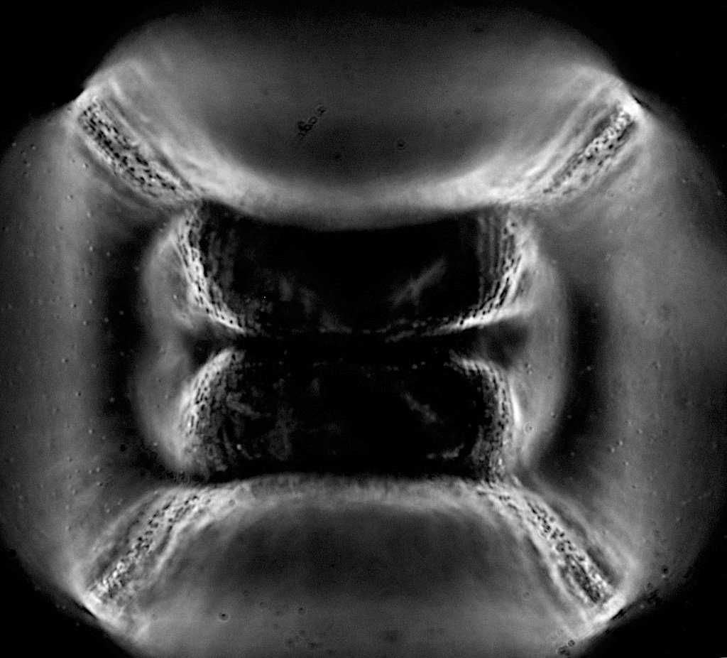 Diatomee Dunkelfeld 100er Zeiss m.I. DSC_9773 1024.JPG