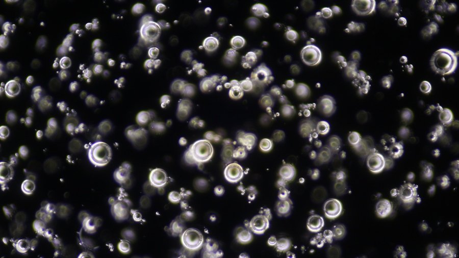 glass bubbles, condenser setting 4, field diaphragm= 20.JPG.JPG