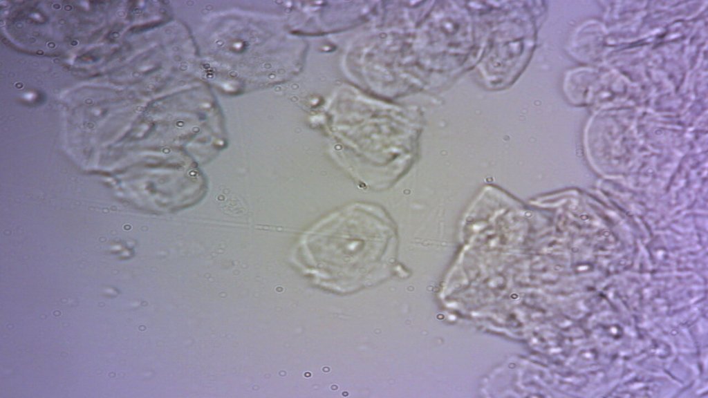 Cheek_Cells.jpg