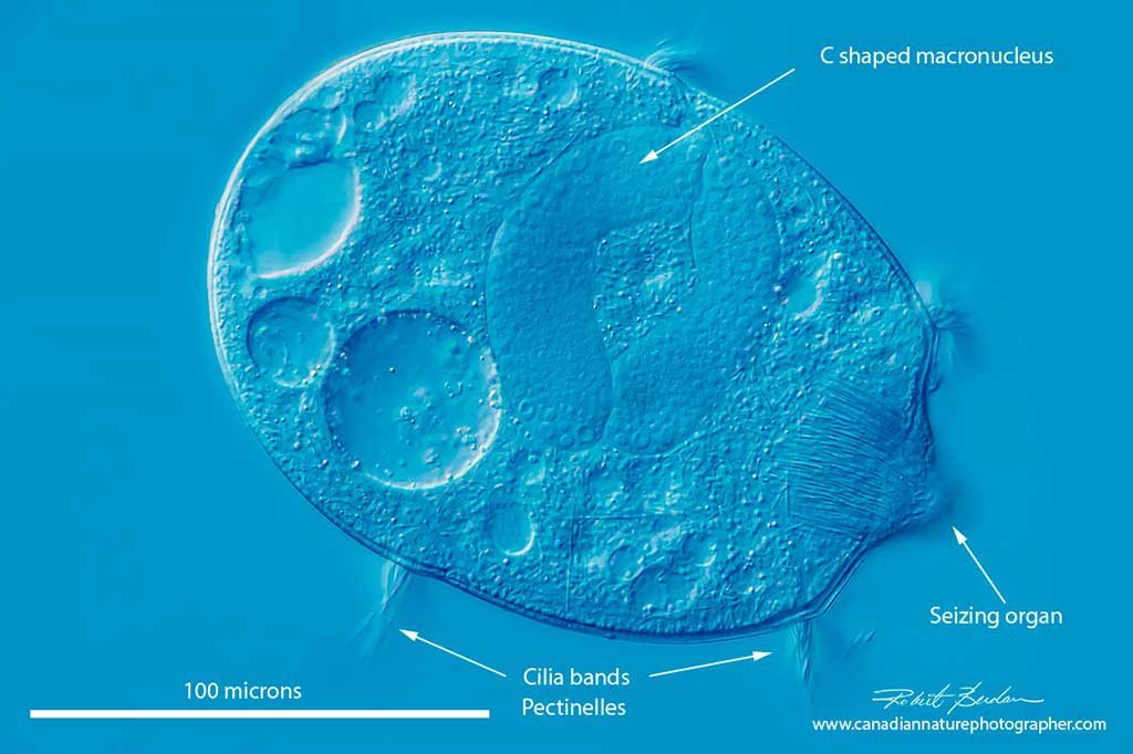 Didinium DIC microscopy