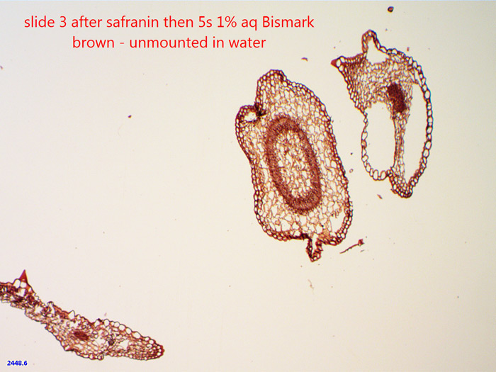 A nice detailed stain - Bismark brown over Safranin