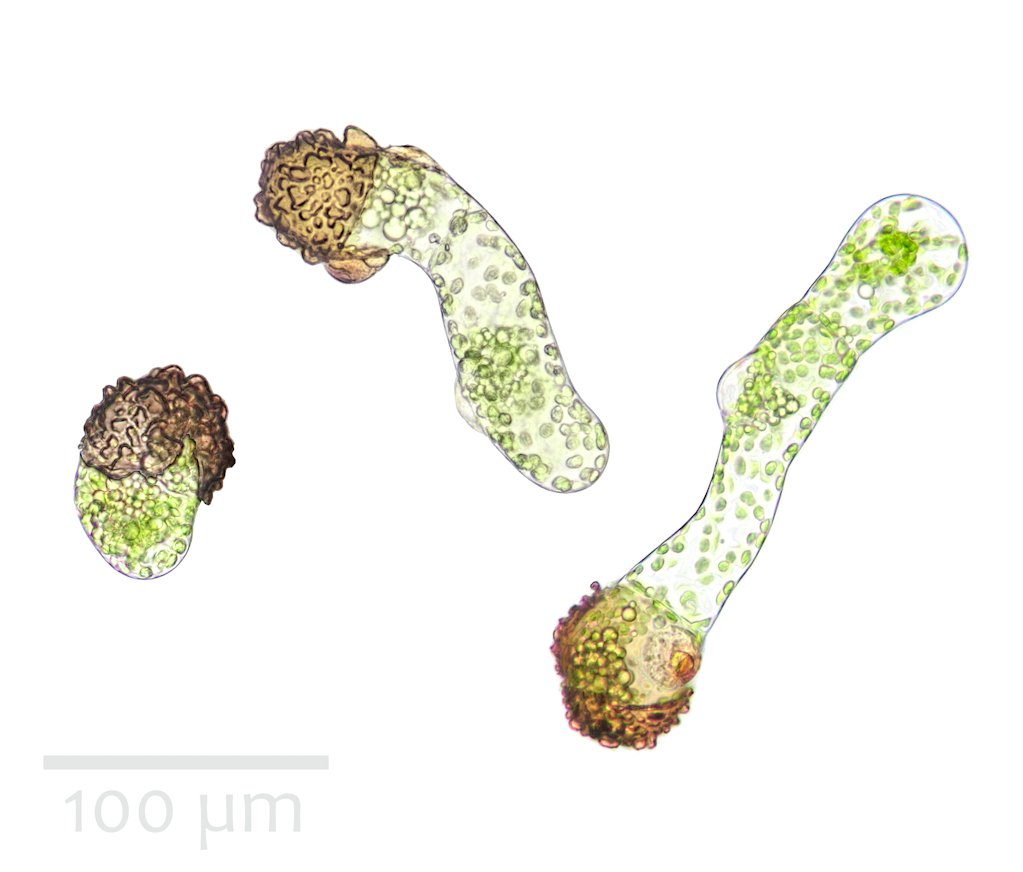 Dryopteris wallichiana germinating spores 40x