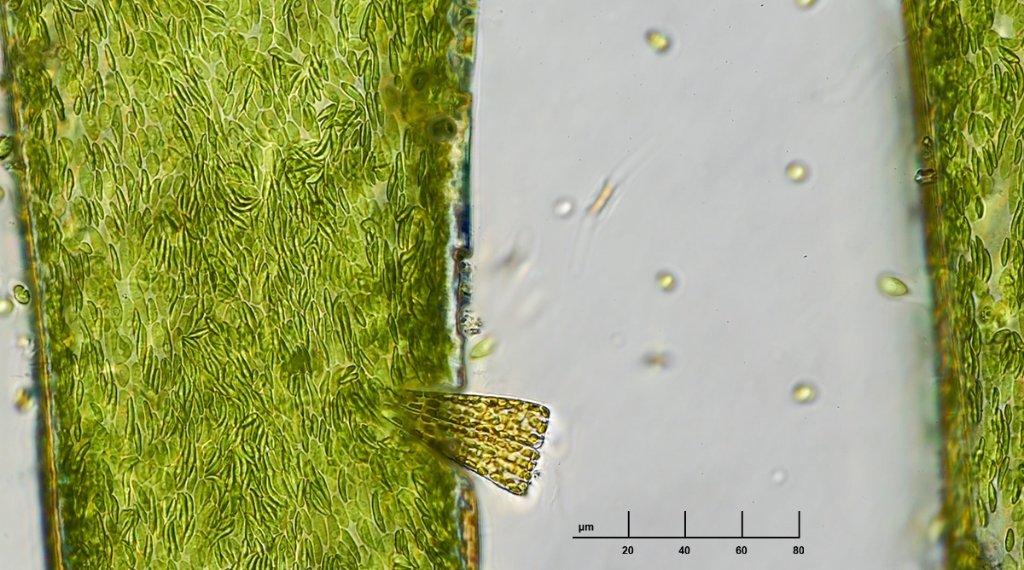 algae strand and wedge diatom stack b sm.jpg