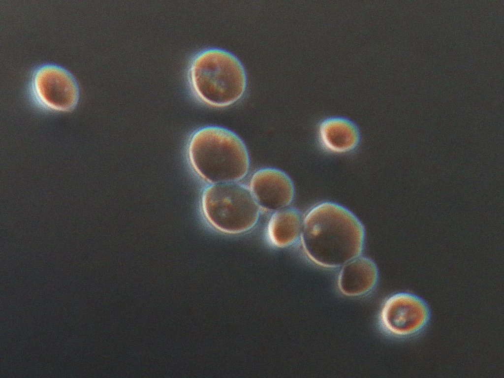 yeast 100x oblique condenser.jpg