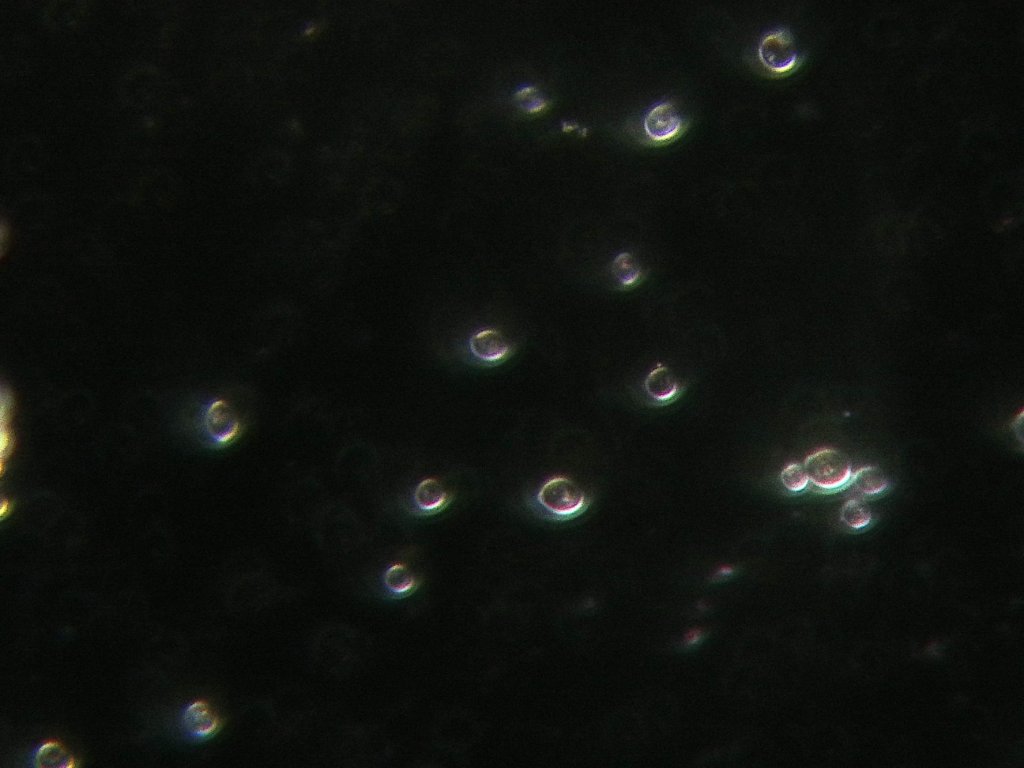 Yeast 40x NA 0.75 with DCW, not adjusted with PVC, a fraction of circle missing