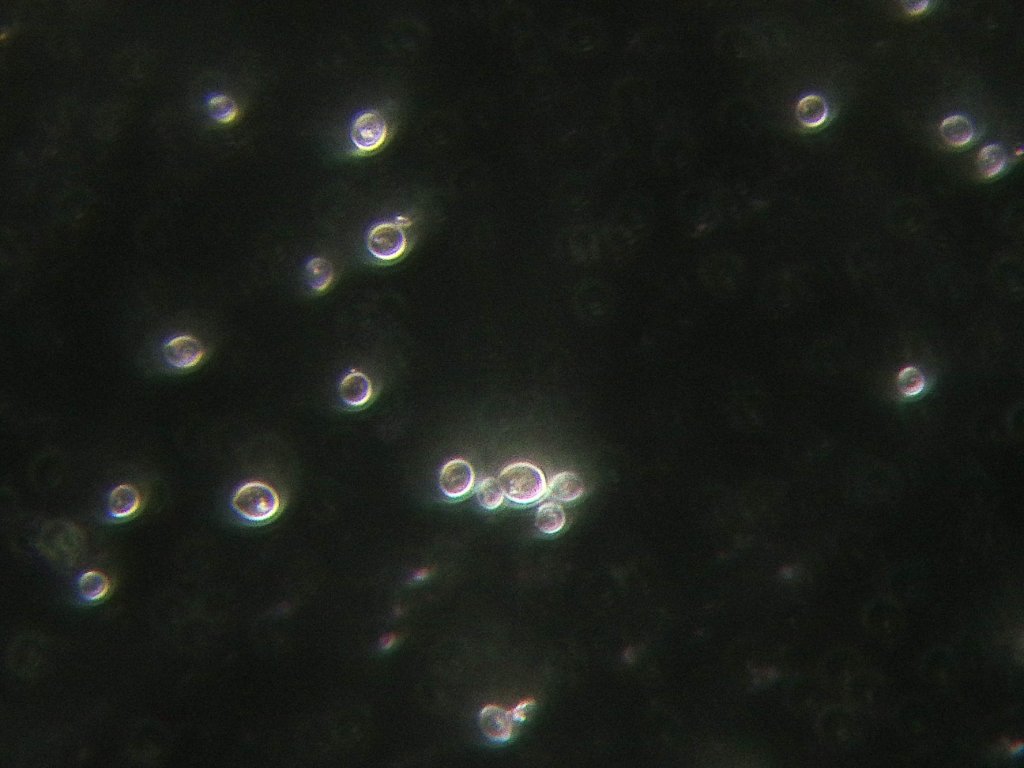 Yeast 40x NA 0.75 with DCW, evenly positioned